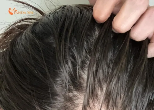 how to keep hair from getting greasy
