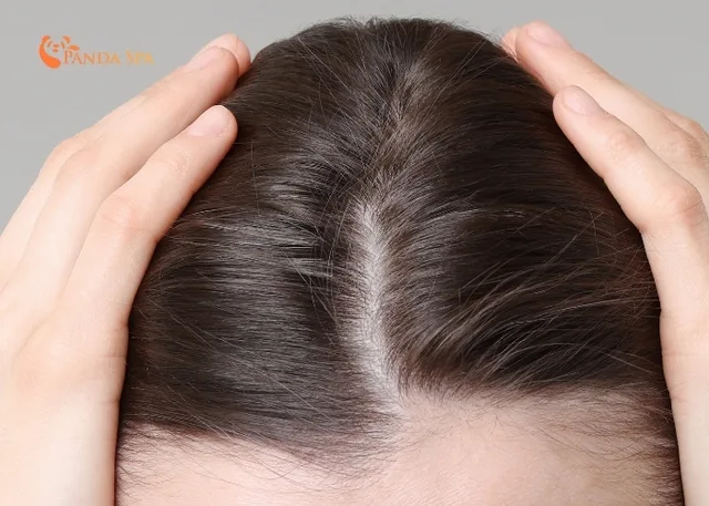 dầu gội mọc tóc