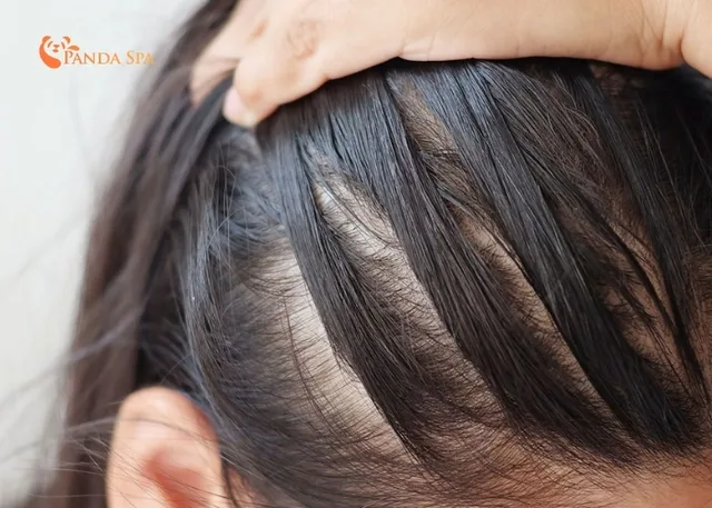 Top 8 Best Anti-Hair Loss Shampoos to Use Today