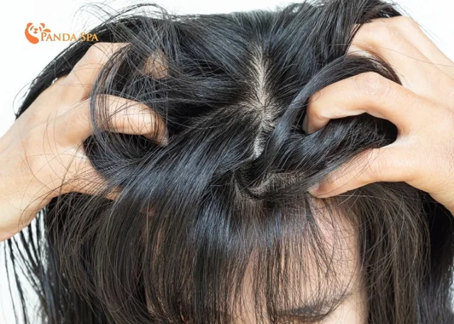 Top dầu gội trị gàu tốt nhất cho từng loại da đầu chuẩn y khoa