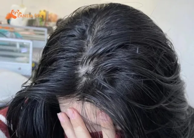 anti-hair loss shampoo