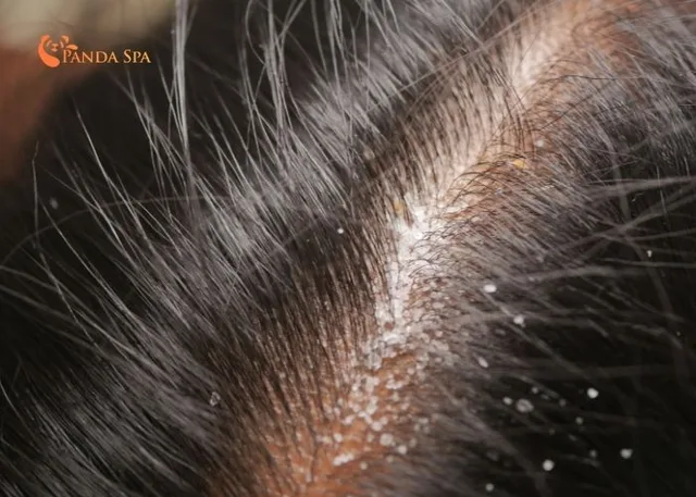 herbal hair spa