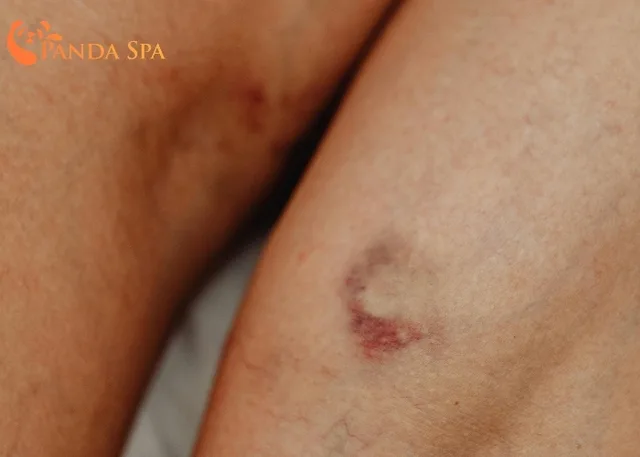 Massage chân có tác dụng gì