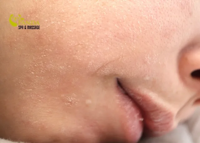 민감성 피부를 건강하게 케어하는 저자극 클렌저 Top 8