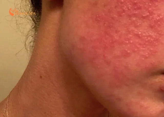 harms of herbal head spa 3
