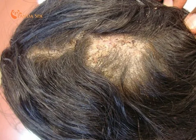 harms of herbal head spa 4