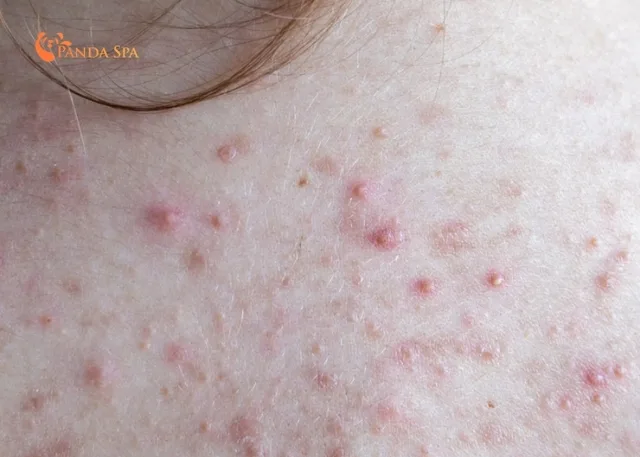 harms of herbal head spa 5