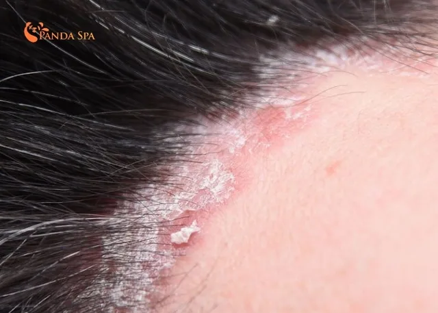 harms of herbal head spa 6